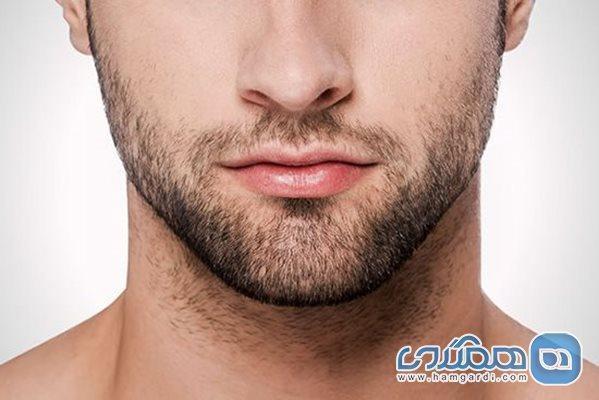 چرا بعضی از مردان ریش ندارند؟ چرا بعضی از مردان ریش ندارند؟
