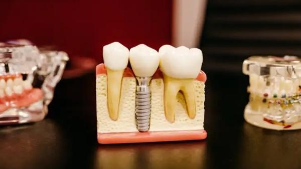 چند نکته مهم درمورد دندان درد که از آن بی خبرید!