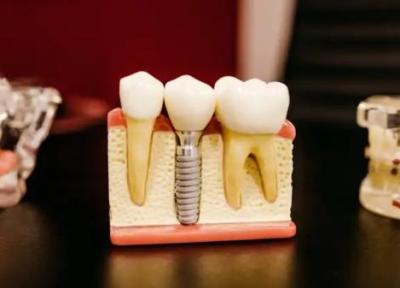 چند نکته مهم درمورد دندان درد که از آن بی خبرید!
