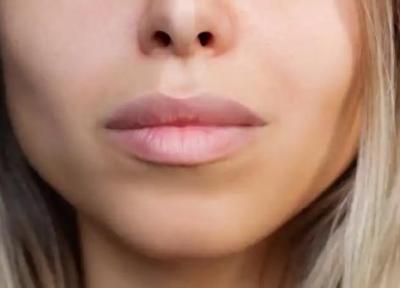 محبوبیت اینستاگرامی شدن چهره همه و زوال نقایص زیبایی شناسانه انسان
